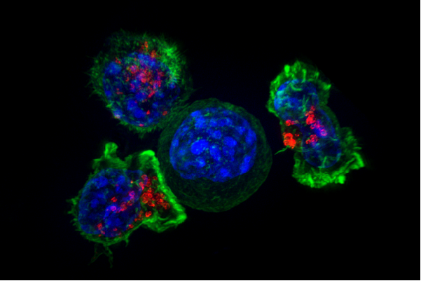 A super resolution image showing killer T cells (blue, red) surrounding cancer cells (blue) | Image: National Institute of Health